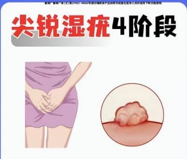 #小姐姐吐槽：西港美业人渣。-manila58.com